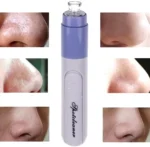 Tree Spot Cleaner Vacuum Pore Cleanser | Blackhead Remover & Deep Facial Cleaner - Image 3