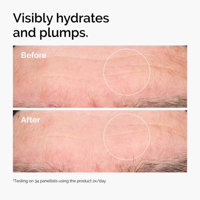 The Ordinary Hyaluronic Acid 2% + B5 (with Ceramides) – 30ml - Image 5