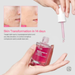 Anua Niacinamide 10% + TXA 4% Dark Spot Correcting Serum - Image 8