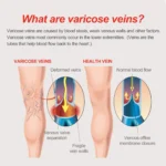Varicose Veins Patch - Image 3