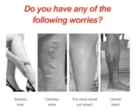 Varicose Veins Patch - Image 4