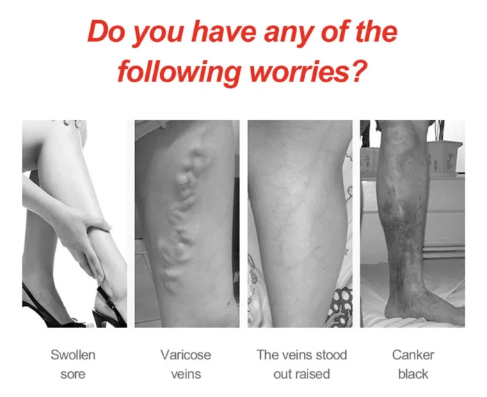 Varicose Veins Patch - Image 4
