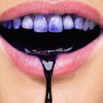 Hismile V34 Purple Teeth Colour Corrector Serum – Advanced Brightening Formula (30ml) - Image 4