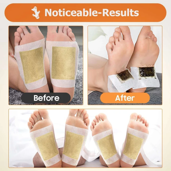 Kinoki Ginger Herbal Foot Pads – Organic Overnight Foot Care & Relaxation Patches (10 Pcs) - Image 8