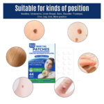 Skin Tag Remover Patches 44 PCs by Royal Prestige - Image 8