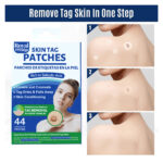 Skin Tag Remover Patches 44 PCs by Royal Prestige - Image 4