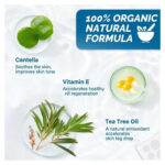 Skin Tag Remover Patches, 66 Patches by Royal Prestige - Image 6