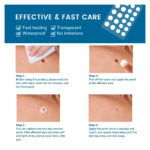 Skin Tag Remover Patches, 66 Patches by Royal Prestige - Image 4