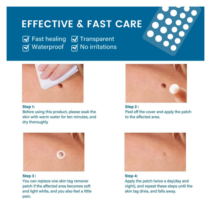 Skin Tag Remover Patches, 66 Patches by Royal Prestige - Image 4