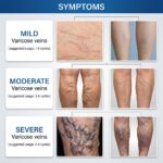Varicose Vein Care Patch (8 Boxes) – Herbal Leg Support Patch for Circulation & Vein Comfort - Image 10