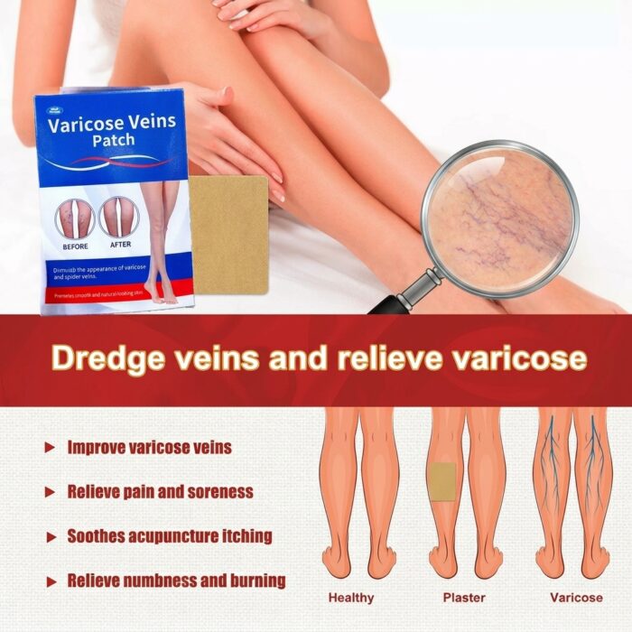 Varicose Vein Care Patch (8 Boxes) – Herbal Leg Support Patch for Circulation & Vein Comfort - Image 13