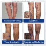 Varicose Vein Care Patch (8 Boxes) – Herbal Leg Support Patch for Circulation & Vein Comfort - Image 14