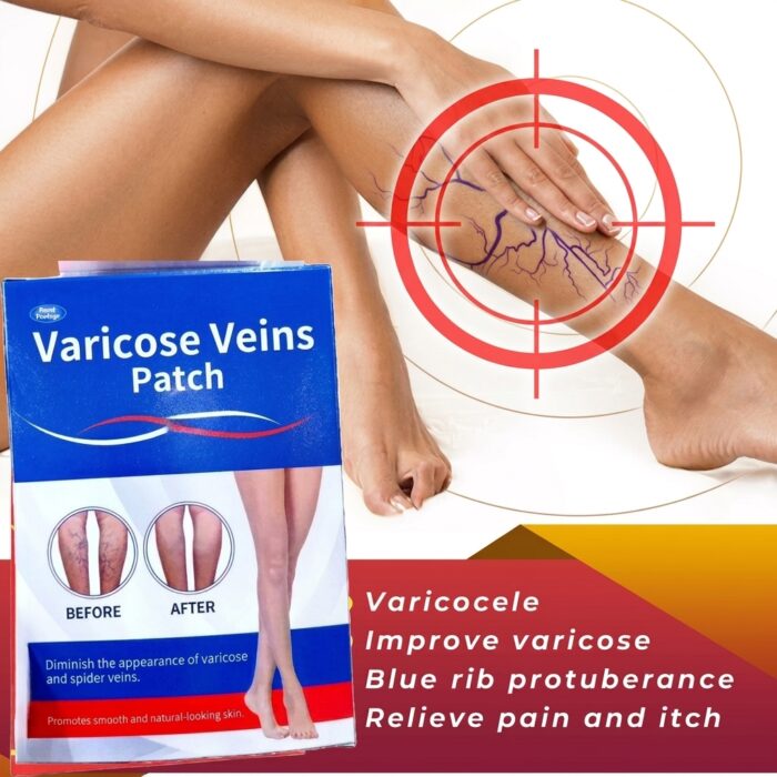 Varicose Vein Care Patch (8 Boxes) – Herbal Leg Support Patch for Circulation & Vein Comfort - Image 18